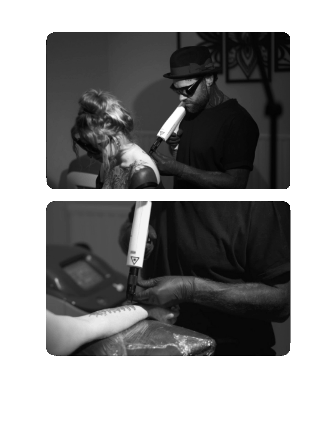Lasertattooborttagning på Lifestyle Tattoo Sundbyberg
